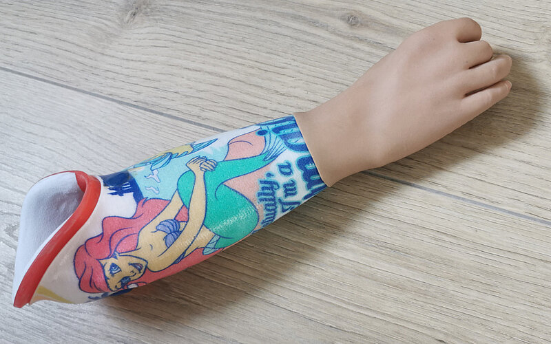 Elektrohand 2000 Ottobock