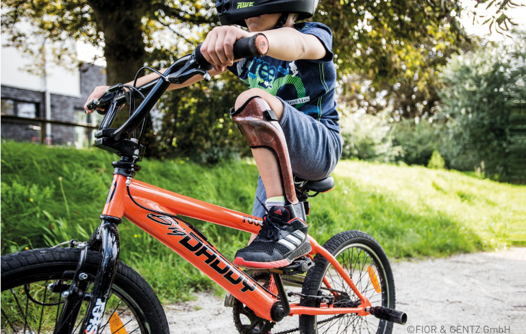 Huesing-Rehatechnik-Orthopaedietechnik-Sitzschale-FiNiFuchs-Kinderrollstuhl Huesing-Rehatechnik-Orthopaedietechnik-Sitzschale-FiNiFuchs-Kinderrollstuhl