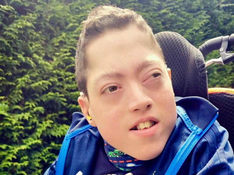 Bohring-Opitz-Syndrom-FiNiFuchs